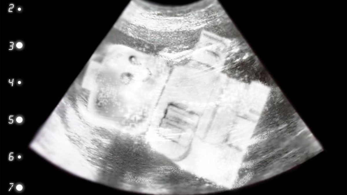 unborn lego